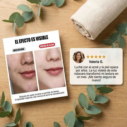 LumiSkin 7X™ Máscara LED Facial | Rejuvenece y mejora la piel desde casa